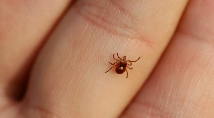 TICK BITE