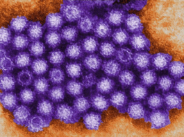 Norovirus is on the Rise in California