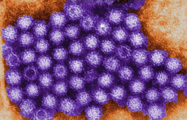 Norovirus is on the Rise in California